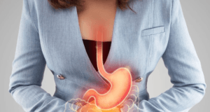 Leia mais sobre o artigo Tratamento Nutricional na Hérnia de Hiato